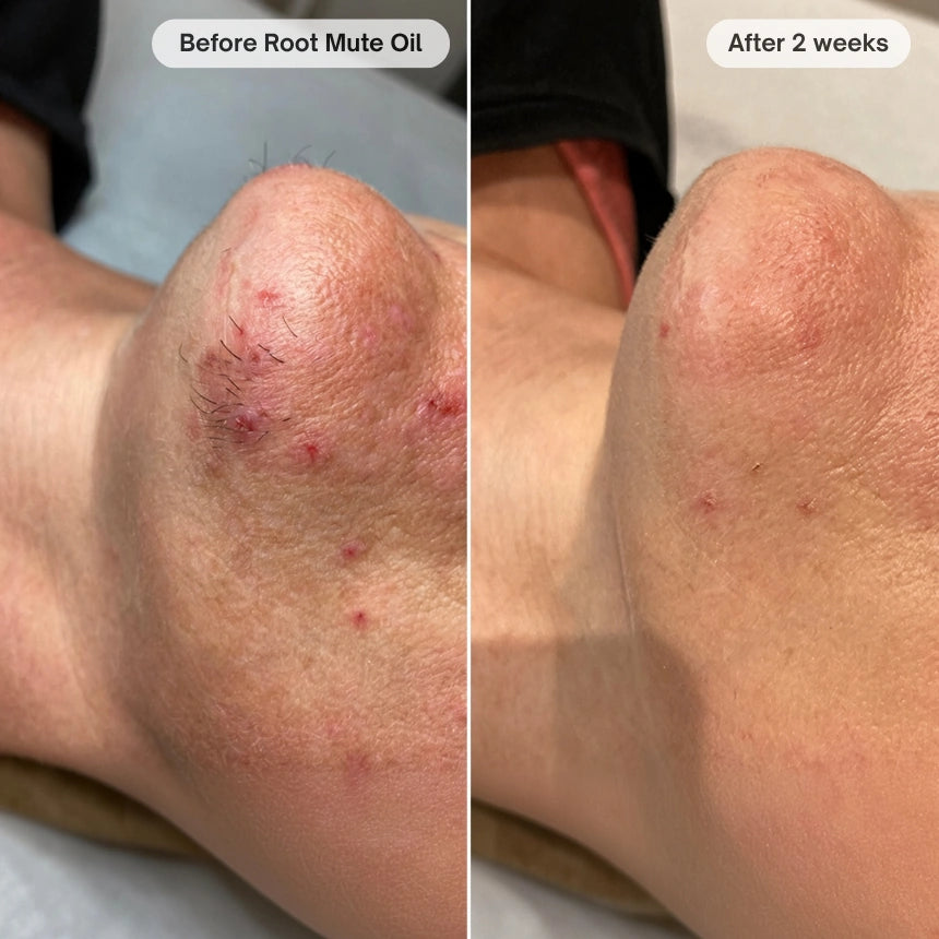 Before and after customer transformation 2