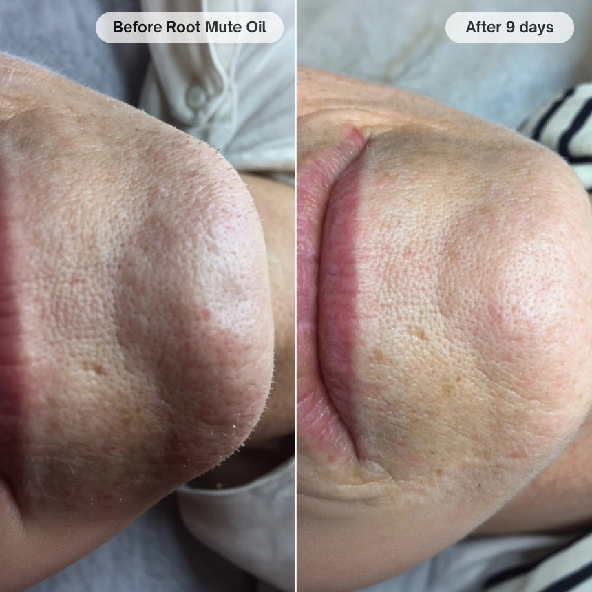 Before and after customer transformation 3