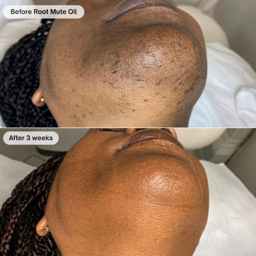 Before and after customer transformation 4